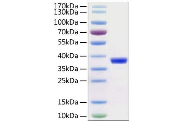 SARS-CoV-2 NSP5 (3CL-Pro) Protein (AA 1-306) (His-Avi Tag)