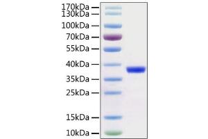 Recombinant 2019-nCoV 3C-like Proteinase with His and Avi tag was determined by SDS-PAGE with Coomassie Blue, showing a band at 38 kDa.