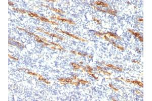 Formalin-fixed, paraffin-embedded human Tonsil stained with CD34 Monoclonal Antibody (QBEnd/10 + HPCA1/763) (CD34 antibody)