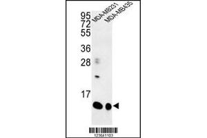Western blot analysis of SPRR1B Antibody in MDA-MB231, MDA-MB435 cell line lysates (35ug/lane)