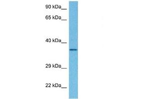 Host:  Rabbit  Target Name:  DHRS7B  Sample Tissue:  Human HepG2 Whole Cell  Antibody Dilution:  1ug/ml (DHRS7B antibody  (Middle Region))