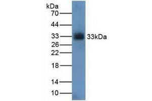 Detection of CDK4 in Rat Kidney Tissue using Polyclonal Antibody to Cyclin Dependent Kinase 4 (CDK4) (CDK4 antibody  (AA 6-295))