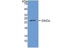Detection of Recombinant GAS6, Human using Polyclonal Antibody to Growth Arrest Specific Protein 6 (GAS6) (GAS6 antibody  (AA 136-311))