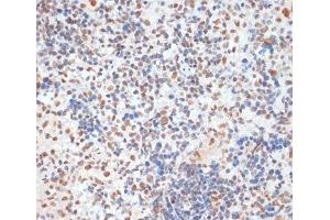 Immunohistochemistry of paraffin-embedded Rat spleen using Phospho-p53(S33) Polyclonal Antibody at dilution of 1:100 (40x lens). (p53 antibody  (pSer33))