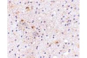Immunohistochemistry of CADPS in human brain with CADPS polyclonal antibody  at 5 ug/mL .