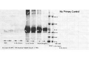 Western Blot of human serum albumin. (Albumin antibody  (HRP))