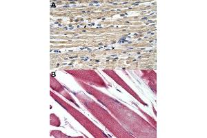 Immunohistochemical staining (Formalin-fixed paraffin-embedded sections) of human skeletal muscle (A, B) with GSTM2 polyclonal antibody . (GSTM2 antibody  (N-Term))