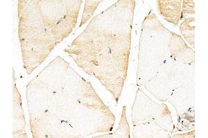ABIN7094381 and ABIN7098428 at 1/100 staining Mouse muscle tissue by IHC-P.