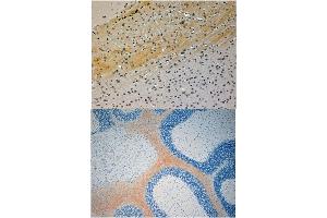 Immunohistochemistry (Paraffin-embedded Sections) (IHC (p)) image for anti-Mitogen-Activated Protein Kinase 8 Interacting Protein 3 (MAPK8IP3) (N-Term) antibody (ABIN1107892) (JIP3 antibody  (N-Term))