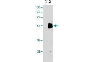 Western blot analysis of PRMT7 (arrow) using PRMT7 polyclonal antibody . (PRMT7 antibody  (C-Term))