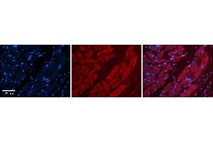 Rabbit Anti-TFB1M Antibody    Formalin Fixed Paraffin Embedded Tissue: Human Adult heart  Observed Staining: Cytoplasmic Primary Antibody Concentration: 1:600 Secondary Antibody: Donkey anti-Rabbit-Cy2/3 Secondary Antibody Concentration: 1:200 Magnification: 20X Exposure Time: 0. (TFB1M antibody  (N-Term))
