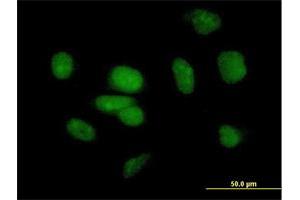 Immunofluorescence of purified MaxPab antibody to PB1 on HeLa cell. (Polybromo 1 antibody  (AA 1-306))