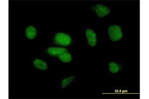 Immunofluorescence of purified MaxPab antibody to PB1 on HeLa cell. (Polybromo 1 antibody  (AA 1-306))