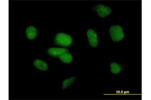 Immunofluorescence of purified MaxPab antibody to PB1 on HeLa cell.