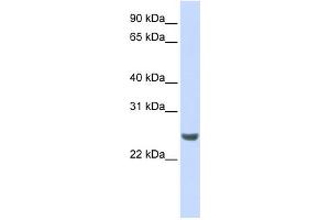 WB Suggested Anti-NKIRAS1 Antibody Titration: 0. (NKIRAS1 antibody  (N-Term))