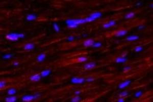 Immunofluorescent analysis of paraformaldehyde-fixed mouse heart using,alpha Actinin (ABIN7073023) at dilution of 1: 500 (alpha Actinin antibody)