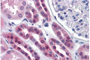 Human Kidney: Formalin-Fixed, Paraffin-Embedded (FFPE) (SDSL antibody  (AA 1-330))