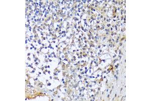 Immunohistochemistry of paraffin-embedded human tonsil using CF antibody (3087) at dilution of 1:100 (40x lens).