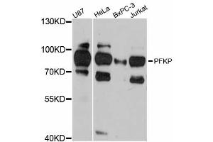 Western blot analysis of extracts of various cell lines, using PFKP antibody (ABIN5998500) at 1:3000 dilution. (PFKP antibody)