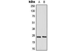 Western blot analysis of GADD153 expression in Jurkat (A), HeLa (B) whole cell lysates.