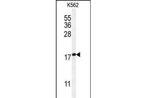 Western blot analysis of KRT1 Antibody (Center) (ABIN651241 and ABIN2840150) in K562 cell line lysates (35 μg/lane). (KRTAP1-1 antibody  (AA 88-117))