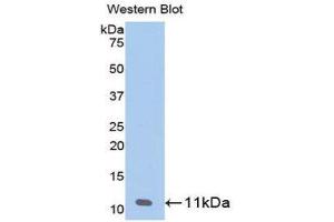 Western Blotting (WB) image for anti-Pro-Platelet Basic Protein (Chemokine (C-X-C Motif) Ligand 7) (PPBP) (AA 59-128) antibody (ABIN1858176) (CXCL7 antibody  (AA 59-128))