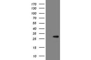 Image no. 1 for anti-RNA Binding Protein with Multiple Splicing (RBPMS) antibody (ABIN1500643) (RBPMS antibody)