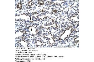 Human Lung (CIC antibody  (N-Term))