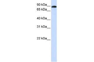 WB Suggested Anti-ADAM19 Antibody Titration:  0. (ADAM19 antibody  (N-Term))
