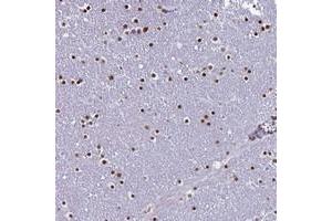 Immunohistochemical staining of human lateral ventricle with LCE6A polyclonal antibody  shows strong nuclear positivity in glial cells.