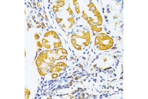 Immunohistochemistry of paraffin-embedded human stomach using MMP2 antibody (ABIN5973678) at dilution of 1/100 (40x lens). (MMP2 antibody)