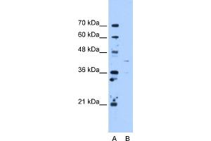 WB Suggested Anti-OAT Antibody Titration:  5. (OAT antibody  (C-Term))
