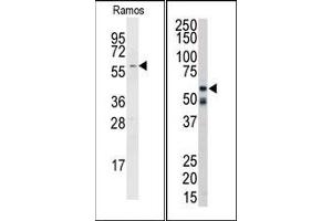 Image no. 1 for anti-Receptor-Interacting Serine-threonine Kinase 2 (RIPK2) (C-Term) antibody (ABIN360158) (RIPK2 antibody  (C-Term))