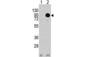 Western Blotting (WB) image for anti-Small Nuclear Ribonucleoprotein Polypeptide E (SNRPE) antibody (ABIN3003509) (SNRPE antibody)