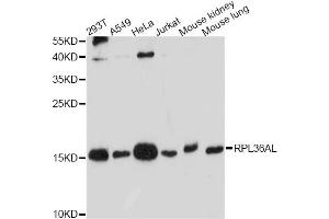Western blot analysis of extracts of various cell lines, using RPL36AL antibody. (RPL36AL antibody)