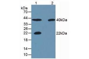 Western blot analysis of (1) Porcine Skeletal Muscle Tissue, (2) Rat Skeletal Muscle Tissue, (3) Human Liver Tissue and (4) Human Lung Tissue. (CA3 antibody  (AA 2-260))