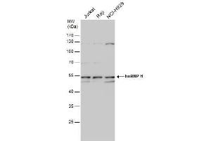 WB Image hnRNP H antibody detects hnRNP H protein by western blot analysis. (HNRNPH1 antibody  (C-Term))