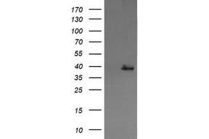 Image no. 1 for anti-Mitogen-Activated Protein Kinase Kinase 3 (MAP2K3) antibody (ABIN1499416) (MAP2K3 antibody)