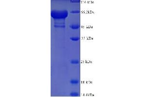 SDS-PAGE (SDS) image for Keratin 14 (KRT14) (AA 1-472), (full length) protein (His tag) (ABIN5713594) (KRT14 Protein (AA 1-472, full length) (His tag))