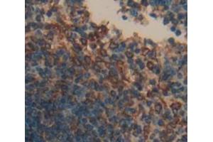Used in DAB staining on fromalin fixed paraffin- embedded Kidney tissue (CD72 antibody  (AA 143-345))