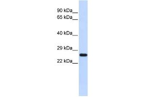 WB Suggested Anti-SOD2 Antibody Titration: 0. (SOD2 antibody  (N-Term))