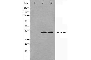 Western blot analysis on COS7 and HuvEc cell lysate using TRADD Antibody. (TRADD antibody)
