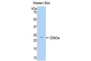 Western Blotting (WB) image for anti-Zyxin (ZYX) (AA 384-572) antibody (ABIN1175612) (ZYX antibody  (AA 384-572))