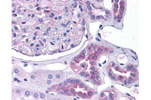 CCL2 antibody was used for immunohistochemistry at a concentration of 4-8 ug/ml.