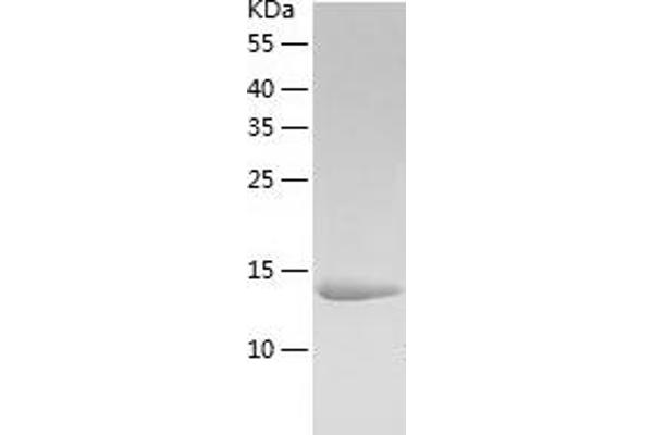 LSM4 Protein (AA 1-139) (His tag)