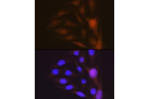 Immunofluorescence analysis of U-2 OS cells using Musashi-1 (MSI1) Rabbit mAb (ABIN7268700) at dilution of 1:100 (40x lens). (MSI1 antibody)