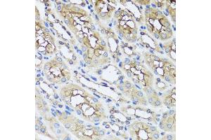 Immunohistochemistry of paraffin-embedded mouse kidney using AIP antibody. (AIP antibody)