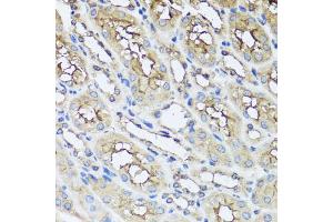 Immunohistochemistry of paraffin-embedded mouse kidney using AIP antibody. (AIP antibody)