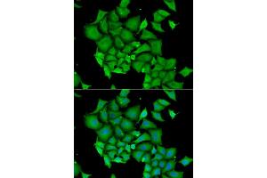 Immunofluorescence analysis of HeLa cell using DFFA antibody. (DFFA antibody)
