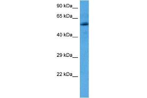 Host:  Rabbit  Target Name:  OXCT2  Sample Tissue:  Human Breast Tumor lysates  Antibody Dilution:  1ug/ml (OXCT2 antibody  (N-Term))